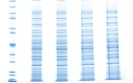 天能VE-586丨Western Blot蛋白免疫印跡常見問題