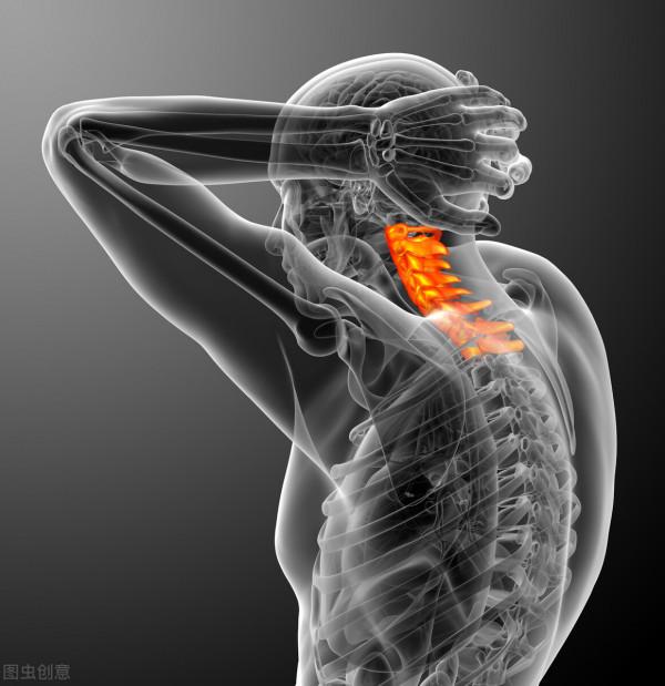 2個用於頸椎病的中成藥，活血化瘀、溫經通絡、止痛，讓氣血通暢