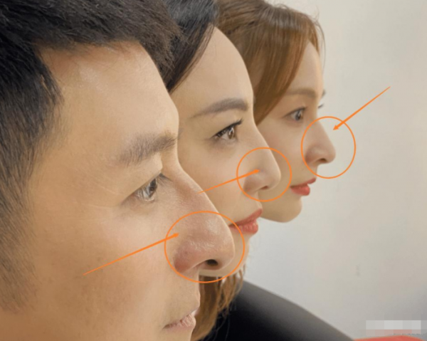 鷹鉤鼻到底好不好看？有人奸險陰沉，有人卻貌美帥氣，why?