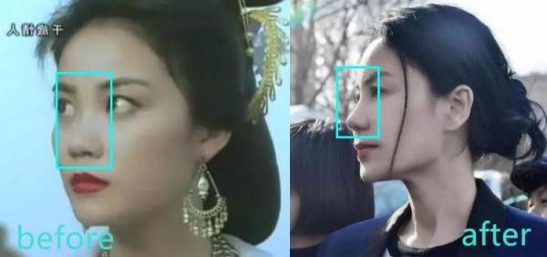 王菲氣質更多來自顴骨和身材，如今鼻子卻攣縮了，逃不過變蔡明