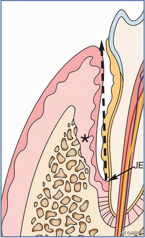 80%貓咪都有牙周炎？貓咪口臭就要警惕