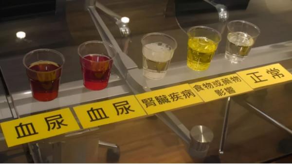 腎好不好一泡尿就能知曉？尿液常有幾種變化，需給腎做檢查