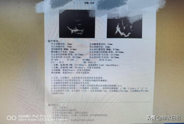 29歲男子從發現泡沫尿到尿毒症僅3年，醫生：只因忽視了這3點