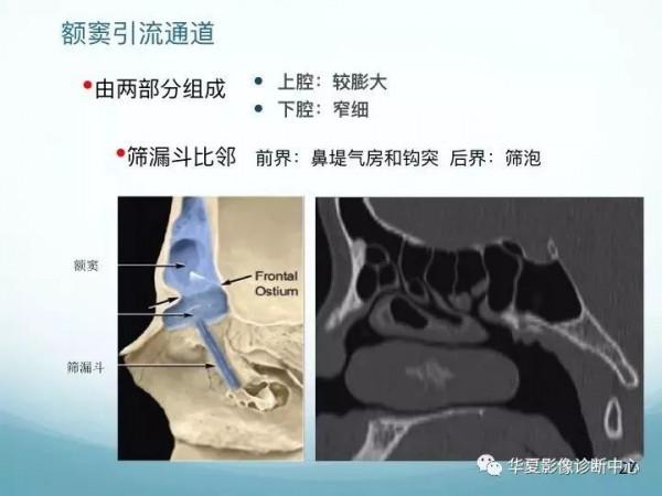 頭頸五官CT斷層解剖圖及常見病影像診斷