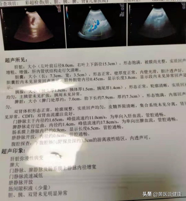 乙肝肝硬化階段,透過積極抗病毒和保肝治療後,效果欠佳怎麼辦? 乙肝肝硬化階段,透過積極抗病毒和保肝治療後,效果欠佳怎麼辦?
