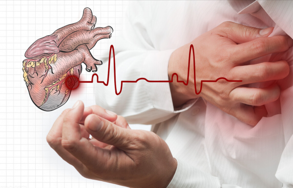 3藥最佳化心肌代謝,平衡能量供應,降低耗氧量,改善冠心病心絞痛 3藥最佳化心肌代謝,平衡能量供應,降低耗氧量,改善冠心病心絞痛