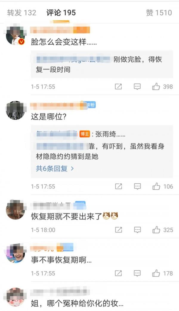 張雨綺榮獲年度美麗女人獎項，網友卻質疑其面部僵硬，疑在恢復期