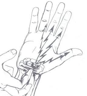 經常手麻 是什麼原因