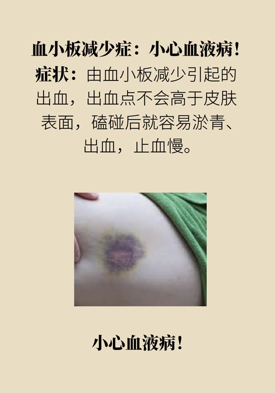 身上出現紅斑、紅點別不當回事，警惕癌變