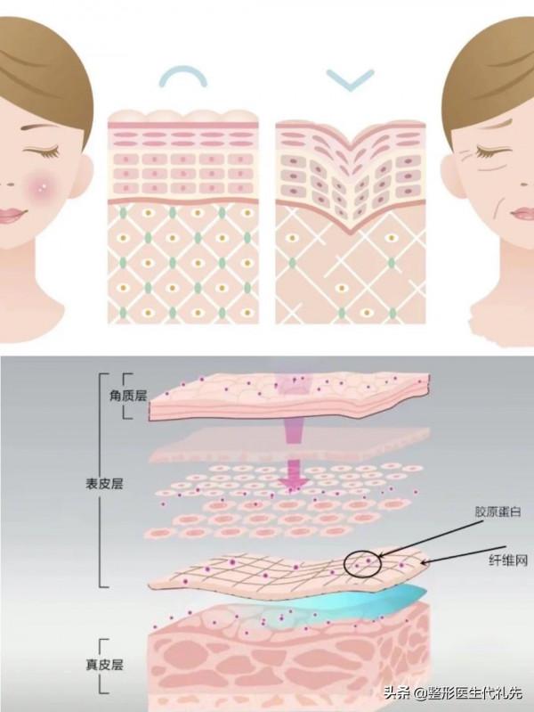 法令紋這麼填,只會越來越深,正確的法令紋改善方案 法令紋這麼填,只會越來越深,正確的法令紋改善方案