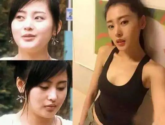 暴瘦的8位女明星，有的餓暈在家，有的難以生育，有的近乎毀容