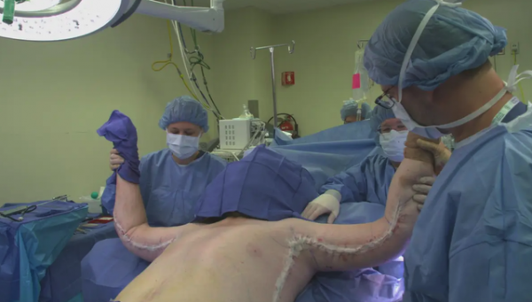 最胖的人能有多胖?住院三年後醫院告知:火化得去屠宰場 最胖的人能有多胖?住院三年後醫院告知:火化得去屠宰場