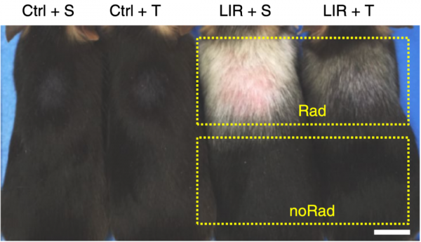 《自然·衰老》：用抗癌的方式抗衰老？中國科學家發現，已獲批的MAPK/ERK抑制劑或可以防止面板衰老丨科學大發現