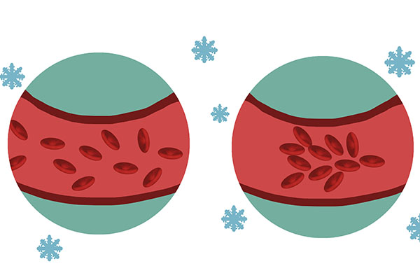 春節是心血管疾病高發期，回家看父母，建議子女注意三件事