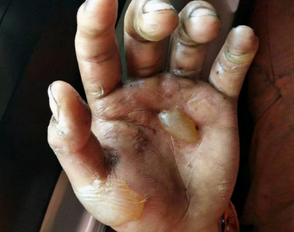 2014年廣西一男孩無依無靠，靠挖野菜為生，獲愛心捐款500萬