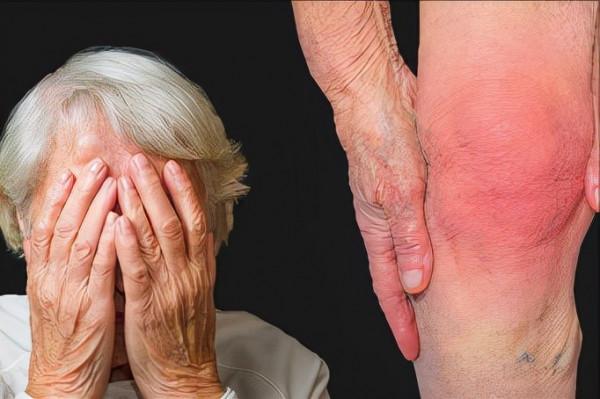 老年人膝關節退變疼痛難忍？7個用藥知識幫您遠離畸形和殘疾