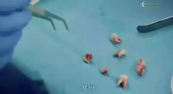 不打孩子,我抽自己還不行嗎? 不打孩子,我抽自己還不行嗎?