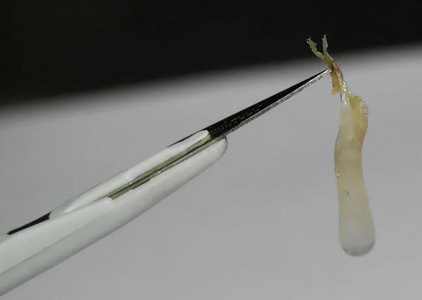 為什麼你會有耳屎、眼屎和鼻屎?它們都是怎麼來的?本文來揭秘 為什麼你會有耳屎、眼屎和鼻屎?它們都是怎麼來的?本文來揭秘