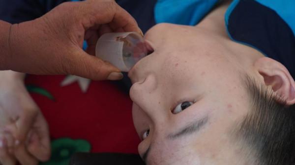 15歲男孩身患重症，被醫生宣判“無期徒刑”，全家人苦盼奇蹟發生