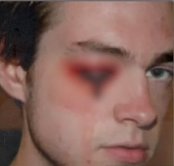 2013年，加拿大富三代買車殺人，用焚化爐毀屍，還殺了父親和女友