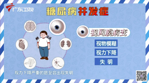 每一個想要管好血糖的人，請收藏好這份控糖妙方