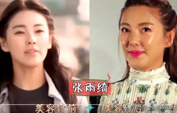 被“美容針”摧殘的女星，戚薇笑都不自然，舒暢真成“天山童姥”