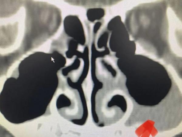 看個普通感冒，花了好幾百元，最後家長還說“真值得”，為什麼？