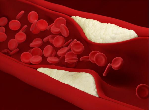 只能控制，無法根治的6種疾病，你知道嗎？本文為你說清楚