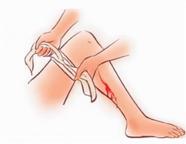 印度一女性睡覺時被毒蛇咬傷,送醫後死亡,毒蛇:這不能怪我 印度一女性睡覺時被毒蛇咬傷,送醫後死亡,毒蛇:這不能怪我