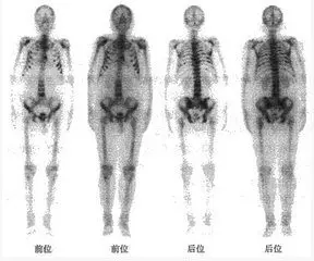 心臟病診斷“七種武器”之七：核醫學