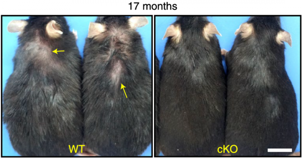 《自然·衰老》：用抗癌的方式抗衰老？中國科學家發現，已獲批的MAPK/ERK抑制劑或可以防止面板衰老丨科學大發現