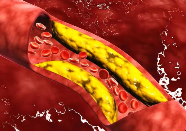 喝酒有好處嗎？醫生：有，但還是要勸你把酒戒掉，這是為啥？