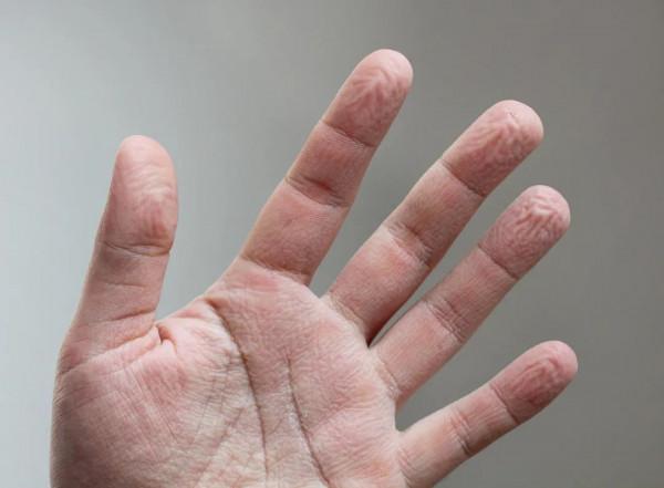手指泡水後變皺，竟是人類的專長？