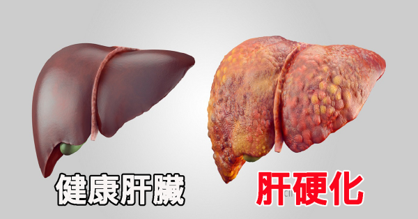 978萬人研究表明:每天喝點“小酒”,比偶爾喝“大酒”更傷身 978萬人研究表明:每天喝點“小酒”,比偶爾喝“大酒”更傷身