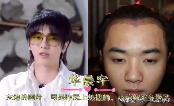 “整容後”一飛沖天的明星,華晨宇屌絲變男神,鞠婧禕越變越好看 “整容後”一飛沖天的明星,華晨宇屌絲變男神,鞠婧禕越變越好看