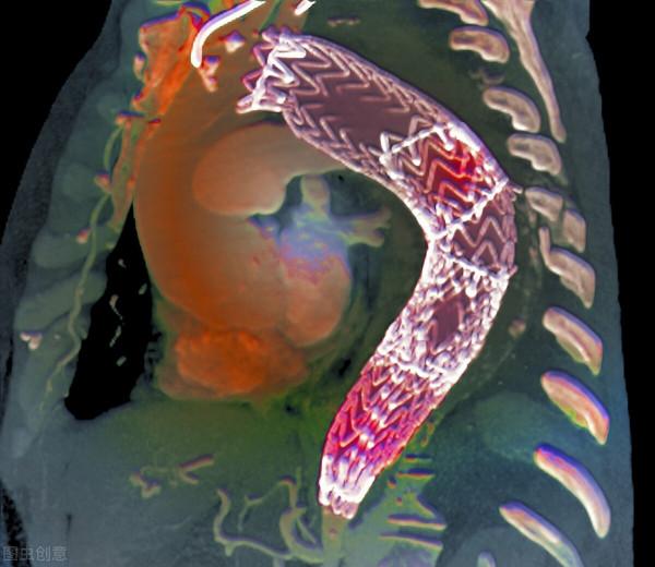 從診斷高血壓到腦出血去世,10年間這位患者經歷了什麼? 從診斷高血壓到腦出血去世,10年間這位患者經歷了什麼?