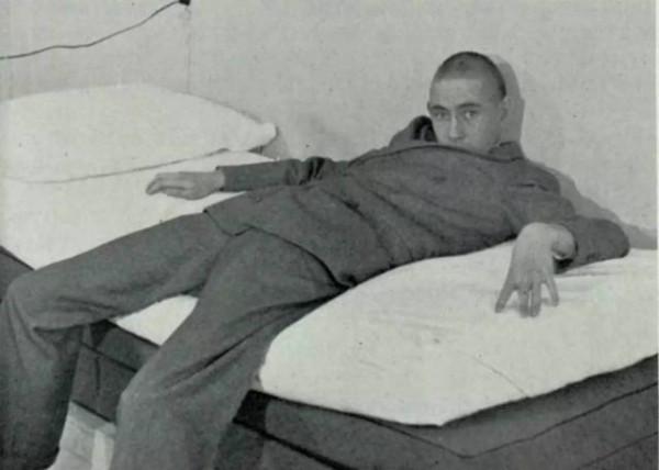 30萬人永無休止的噩夢!1949年的醫學獎:諾貝爾獎史上最大恥辱 30萬人永無休止的噩夢!1949年的醫學獎:諾貝爾獎史上最大恥辱