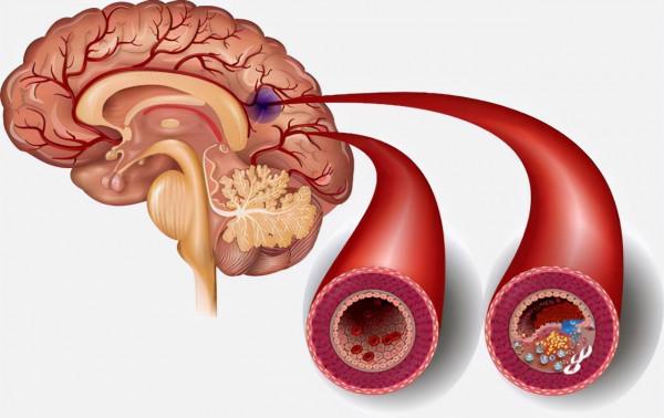現在的老年人，怎樣闖過73歲、熬過84歲兩個坎的呢？看完漲知識了