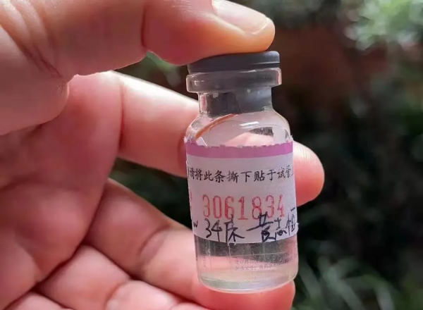 我在中山醫院做肝臟穿刺