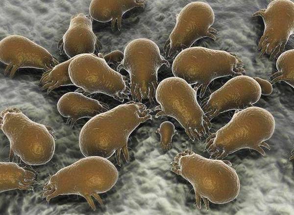 一週沒換的床單,上面竟然都是蟎蟲!試試這幾招輕鬆除蟎 一週沒換的床單,上面竟然都是蟎蟲!試試這幾招輕鬆除蟎