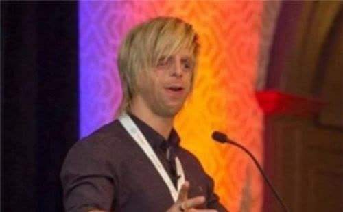 英國男子臉部畸形，憑魅力迎娶美女大學生，孩子出生後笑不出來了