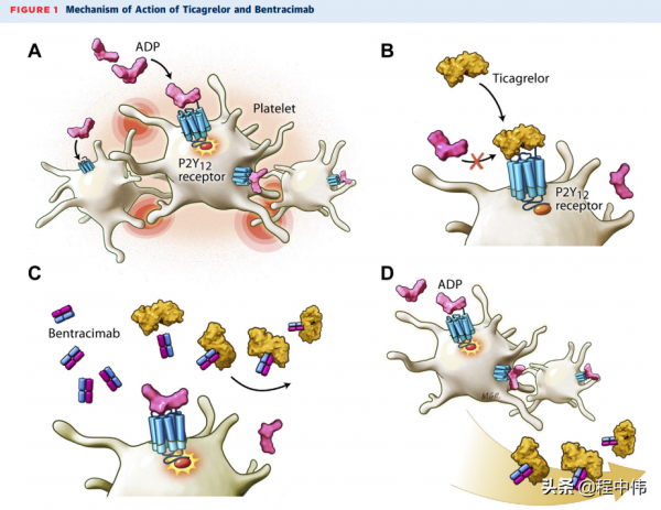 雙重抗血小板治療與顱內出血