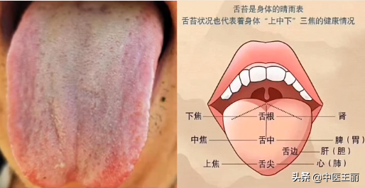 最近整理了一些粉絲的舌診分析，大家可以看看（每日舌象分析）
