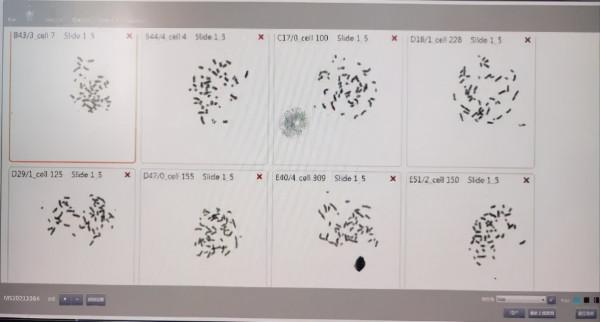 來看看羊水細胞的“奇妙之旅”吧 來看看羊水細胞的“奇妙之旅”吧