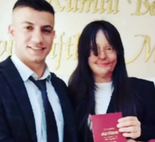 被男友毀容凌辱卻依然嫁他！惡魔減刑釋放！“pua洗腦”還是傻？