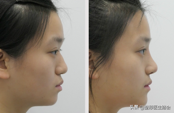 整得再美，也是“一眼假”！想要悄悄變美，怎麼就那麼難？