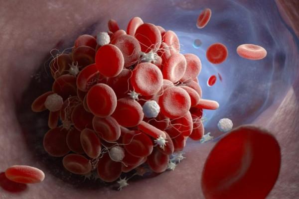 科學家們確定了與重症COVID-19誘發血栓有關的&quot&semi;流氓抗體&quot&semi;