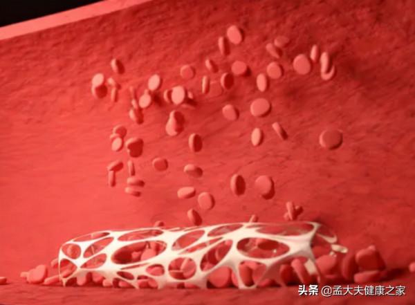 血管“堵”了,心梗、腦中風、猝死來敲門?用5招拯救血管 血管“堵”了,心梗、腦中風、猝死來敲門?用5招拯救血管