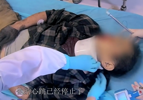 真實故事：農民工意外墜樓，腦袋被摔出血洞，後來搶救過來了嗎？