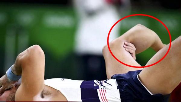 體操傷病真的很嚇人，今天我們就來說說體操這些事件